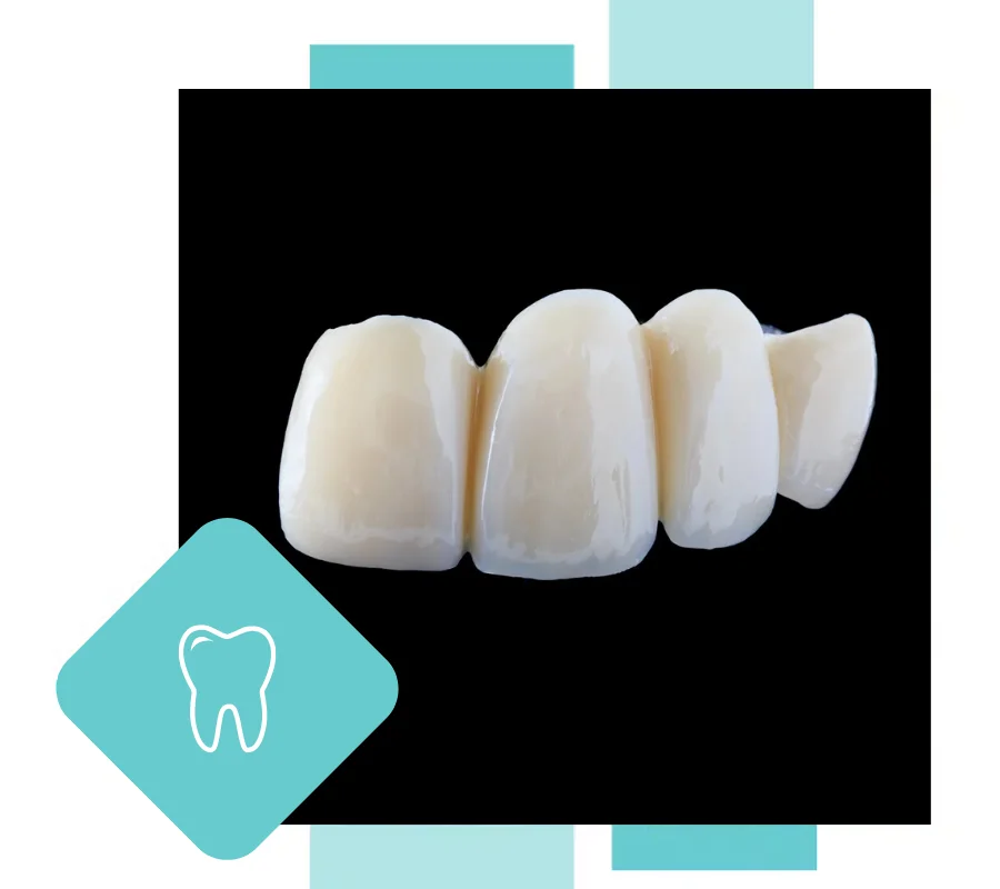 Dental Bridges Hero