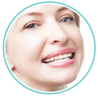 Veneer