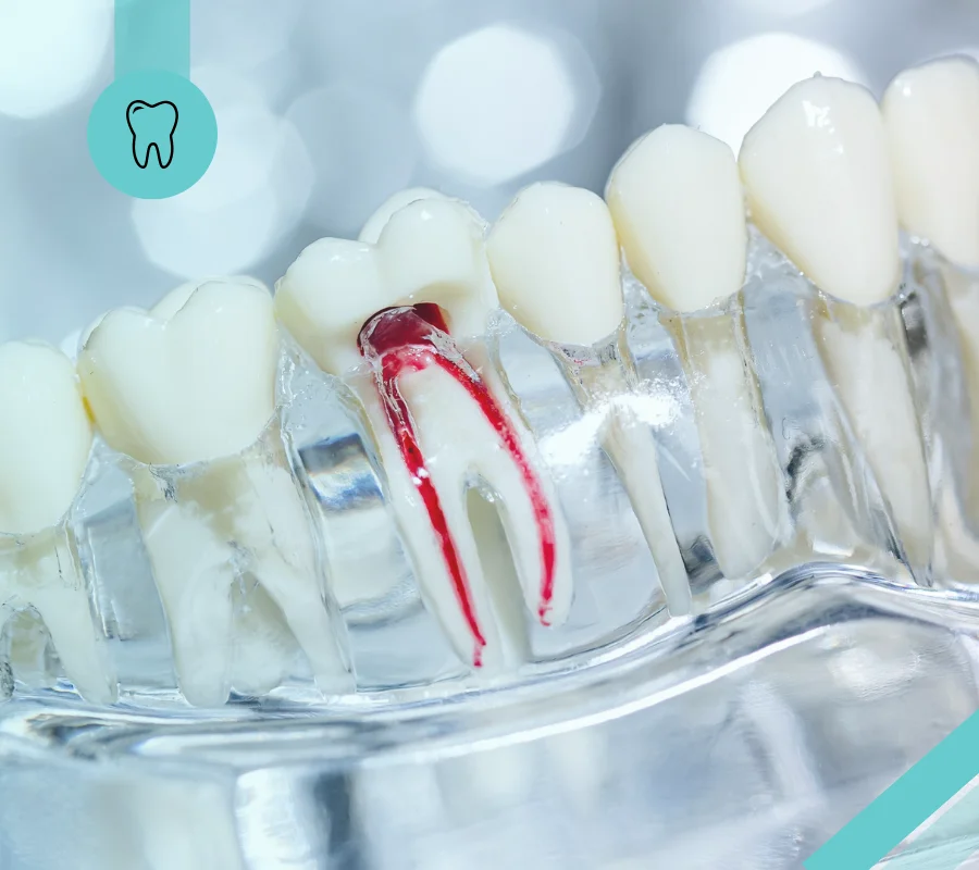root_canal_hero