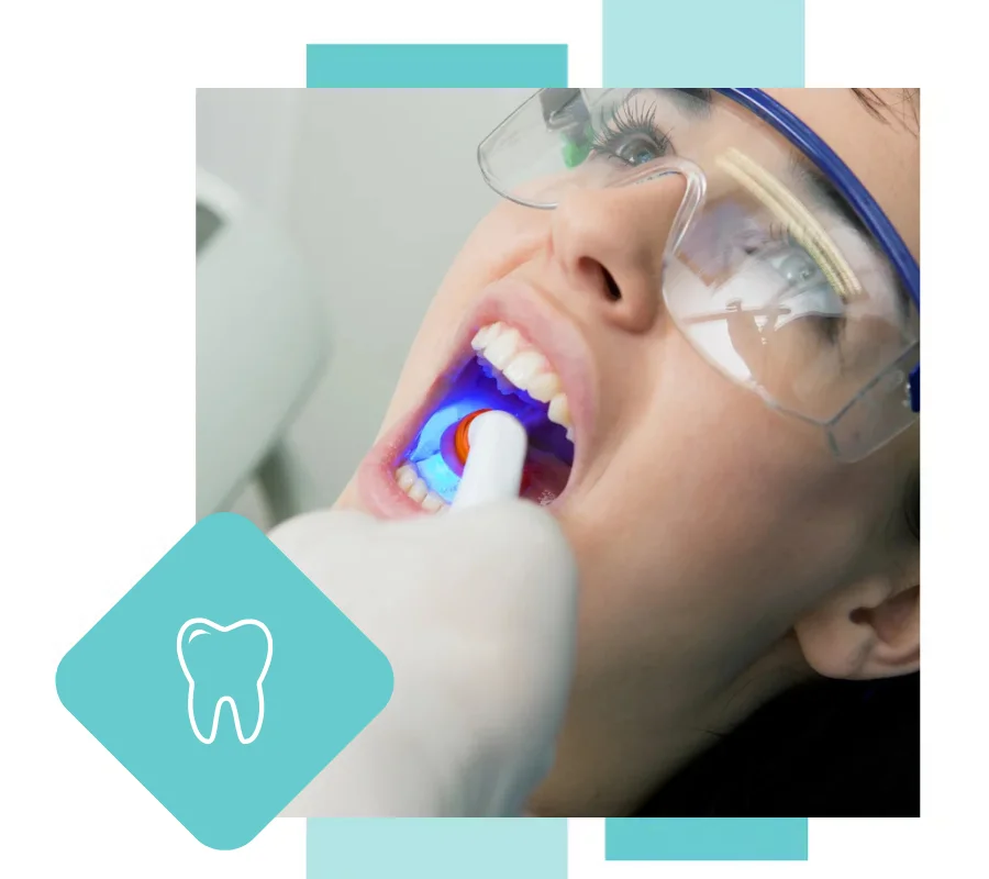 white_fillings_hero